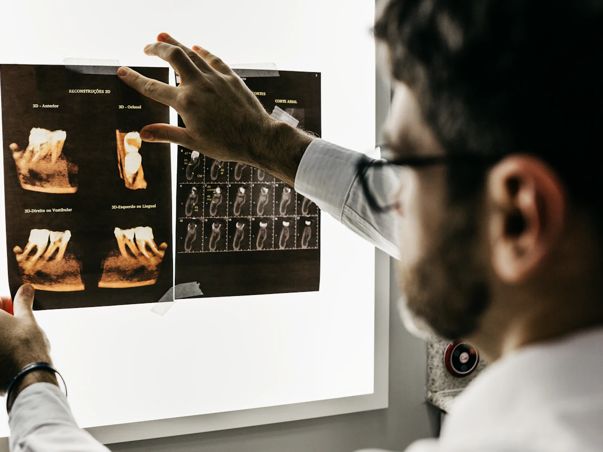 Medic analizând radiografii dentare 3D pe negatoscop